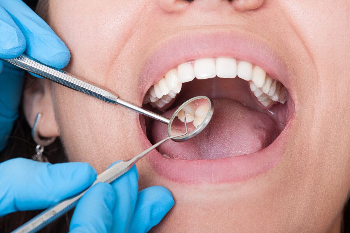 How Long Does A Teeth Cleaning Take How Long Does It Take For A Dentist To Clean Teeth